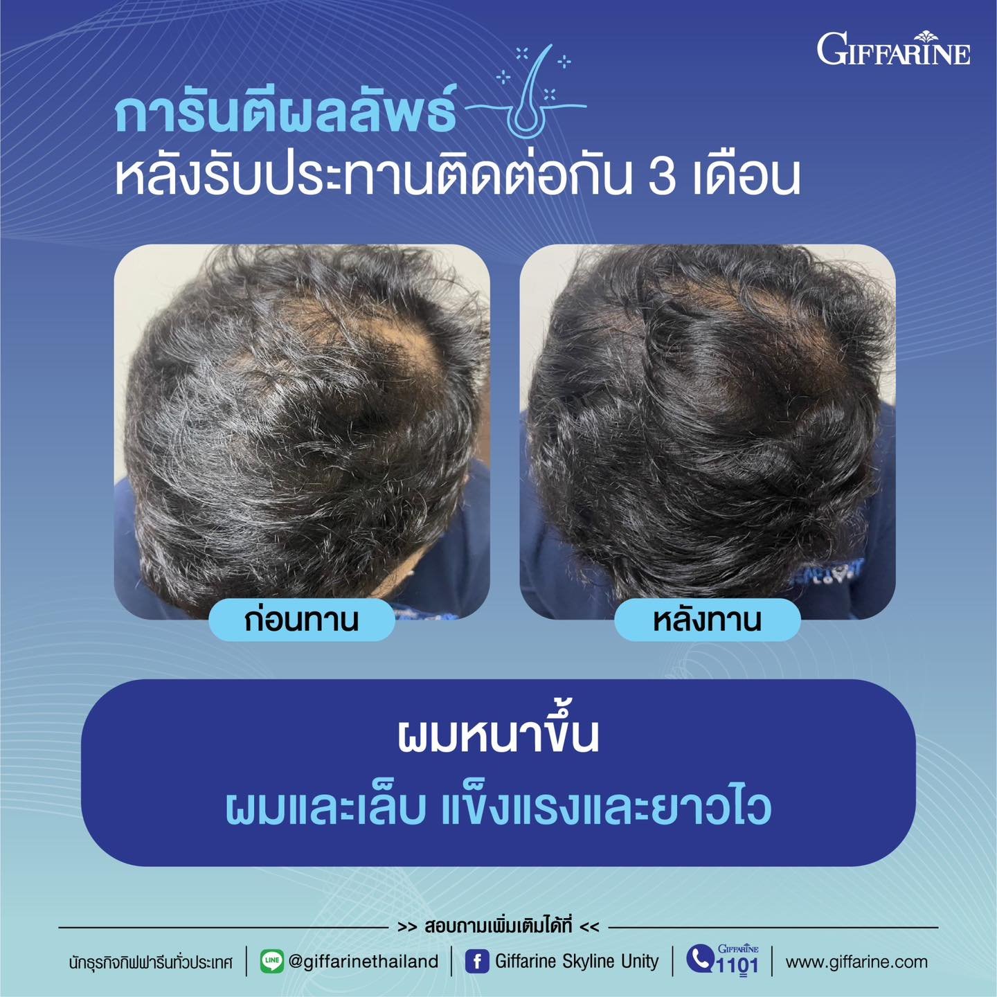 กิฟฟารีน ไบโอติน เอช พลัส Giffarine BIOTIN H PlUS - Image 12