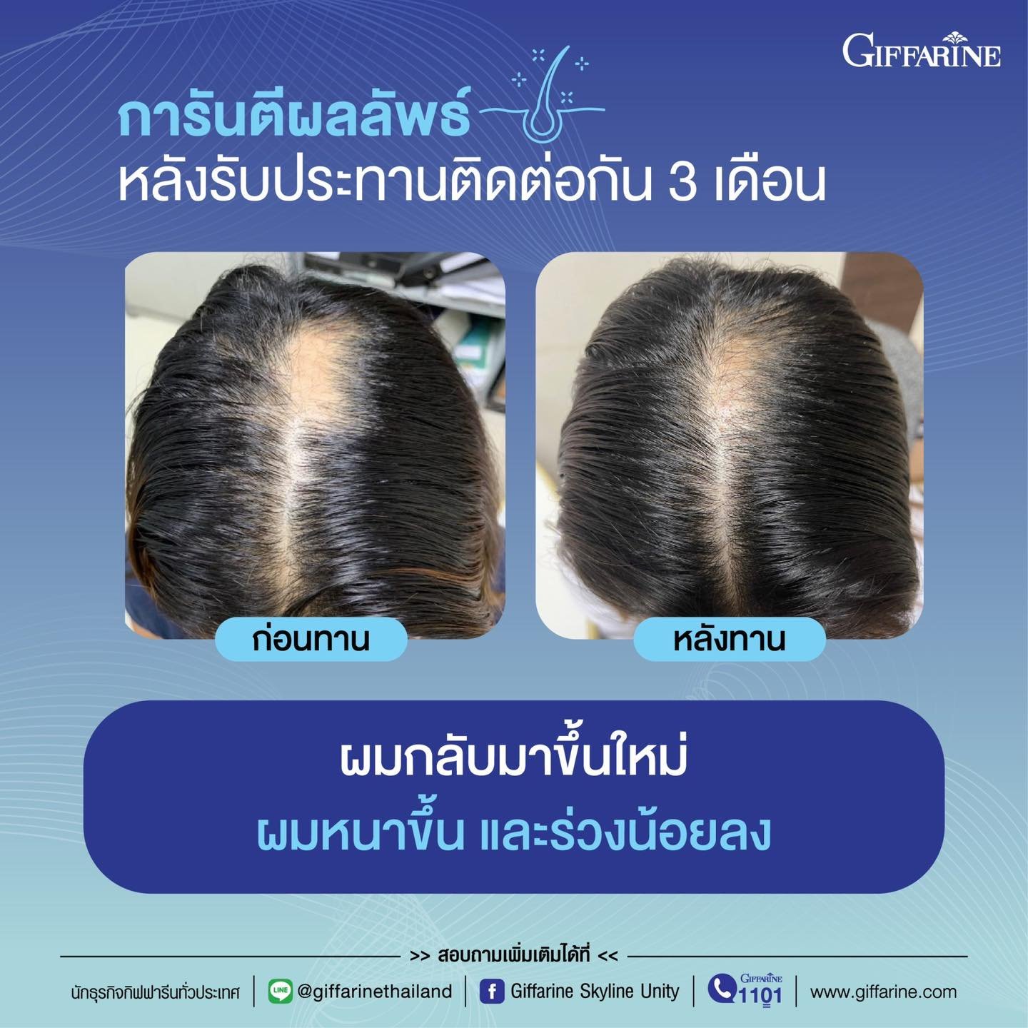 กิฟฟารีน ไบโอติน เอช พลัส Giffarine BIOTIN H PlUS - Image 13