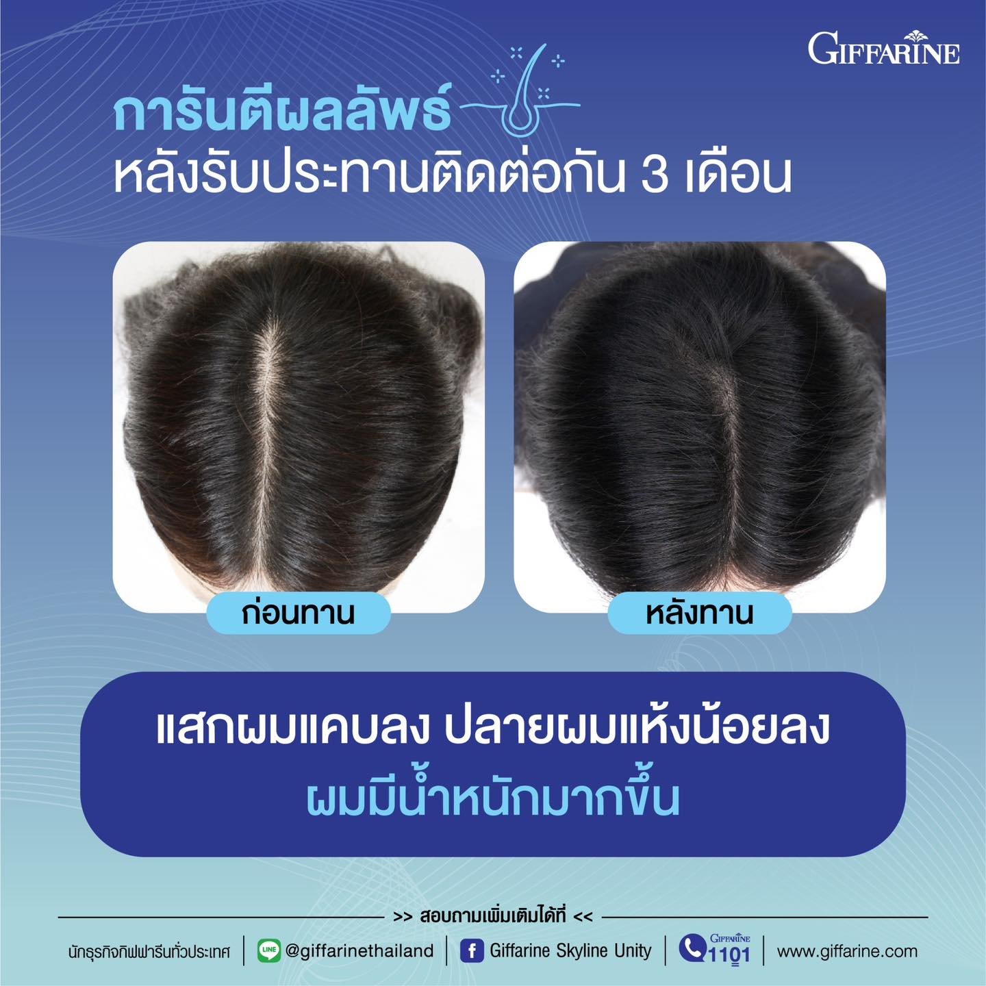 กิฟฟารีน ไบโอติน เอช พลัส Giffarine BIOTIN H PlUS - Image 11